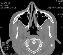 Study of the brain