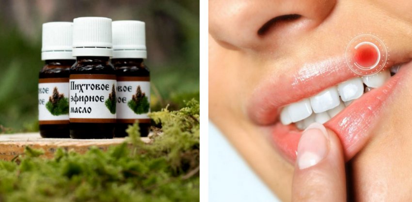 Fir oil for herpes