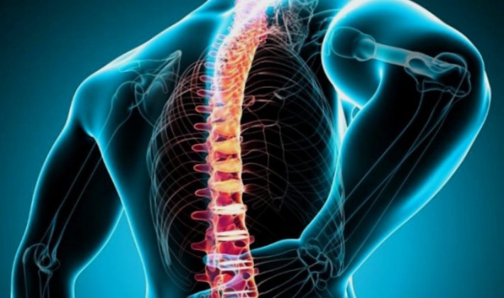 Therapy for diseases of the spine