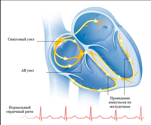 The formation and distribution of electrical impulses is normal