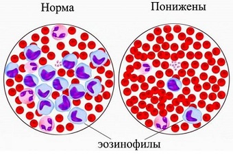 eosinophilic cationic protein