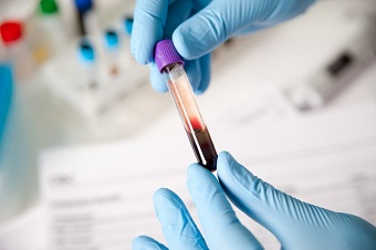 How to correctly interpret the values ​​of ECP in the blood