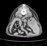 Study of the abdominal cavity and retroperitoneal space