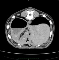 Study of the abdominal cavity and retroperitoneal space