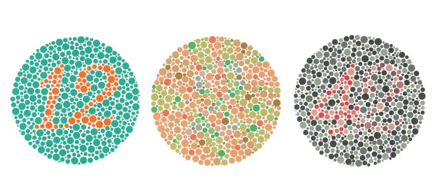 Optic neuritis