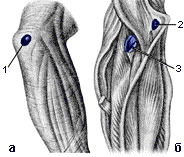 The area of ​​the right elbow joint, rear view (a) and front (b) (Fig. 3)