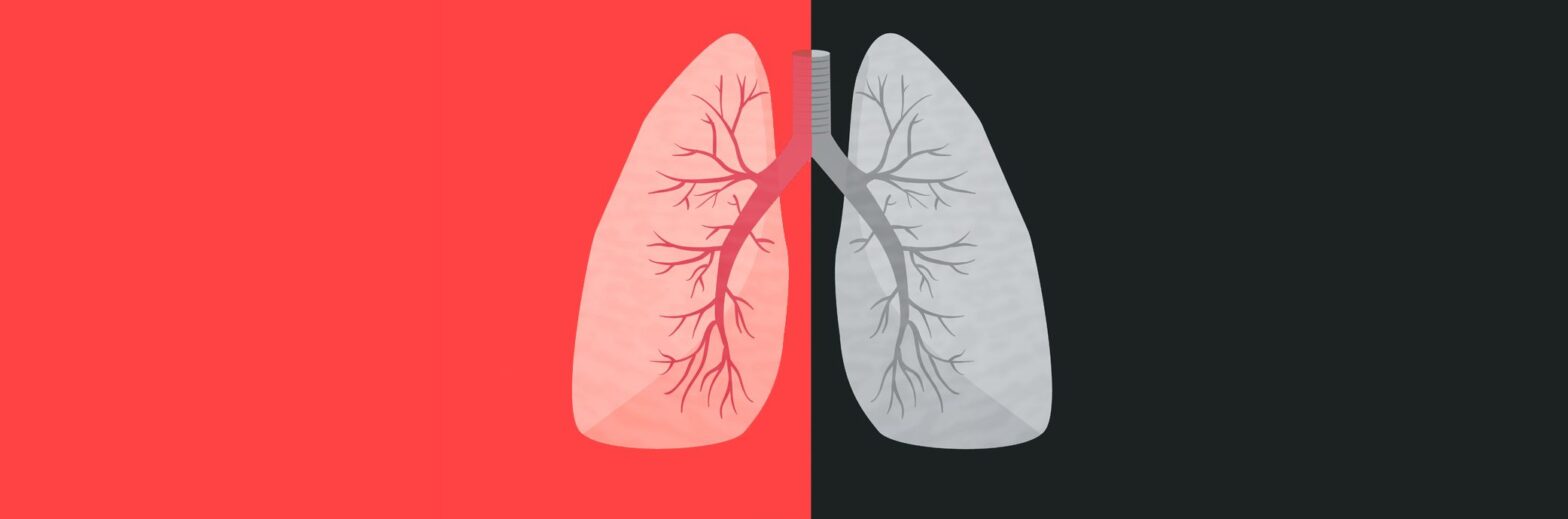 COPD-C.