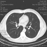 Study of the thoracic cavity