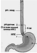 Scheme of the Intrapist Installation of the rh-probation for the diagnosis of GERB