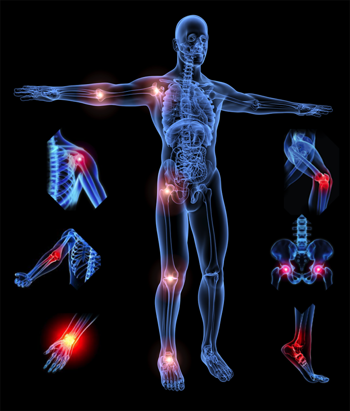 The cost of orthopedic operations for patients from abroad