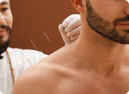 Acupuncture in Chinese medicine