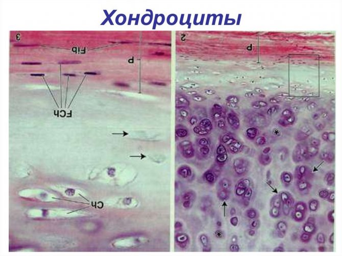 Chondrovit. Produced in Ukraine in the form of capsules. The effectiveness of chondroprotectors of this type is that they normalize the functional state of the joints, regenerate cartilage tissue, and also have an anti-inflammatory effect.